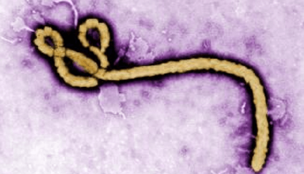 エボラ熱の画像