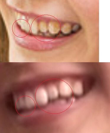 一致する歯並びとホクロの位置の検証画像