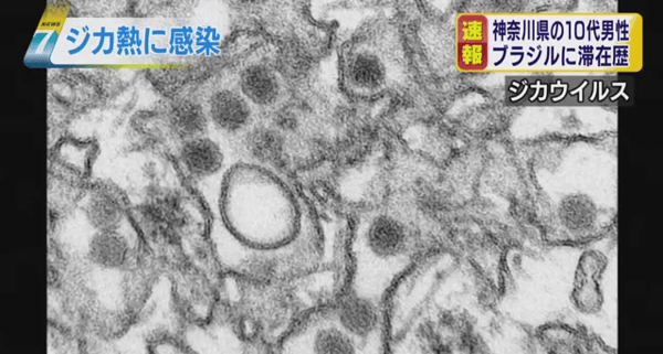 日本人男性が感染したジカ熱のNHKニュース画像