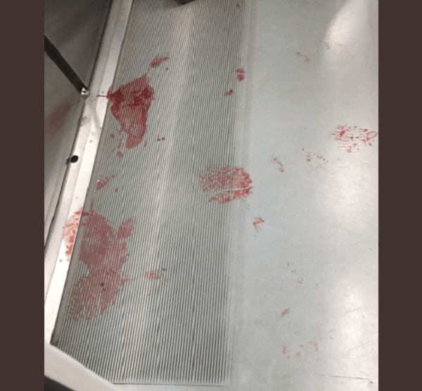 山手線の電車内に大量の血の画像