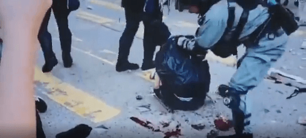 香港警察が意識のない男性を無理やり起こしている画像